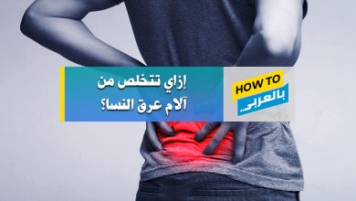 عرق النسا