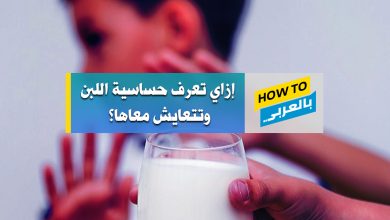 حساسية اللبن
