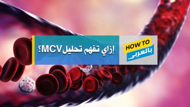 MCV