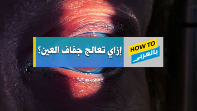 جفاف العين