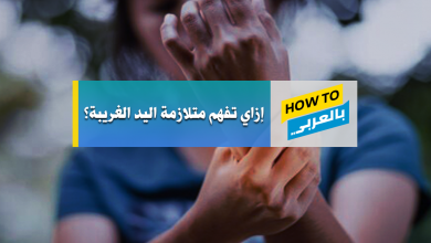 متلازمة اليد الغريبة