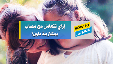 متلازمة داون