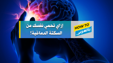 السكتة الدماغية