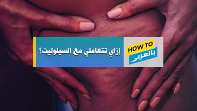 السيلوليت