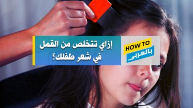 علاج القمل