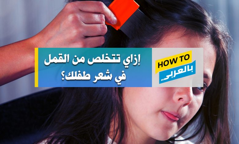 علاج القمل