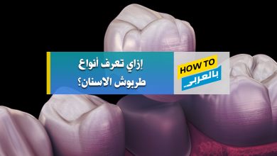 طربوش الاسنان