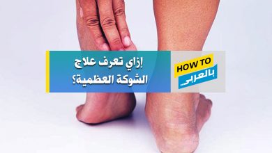 الشوكة العظمية